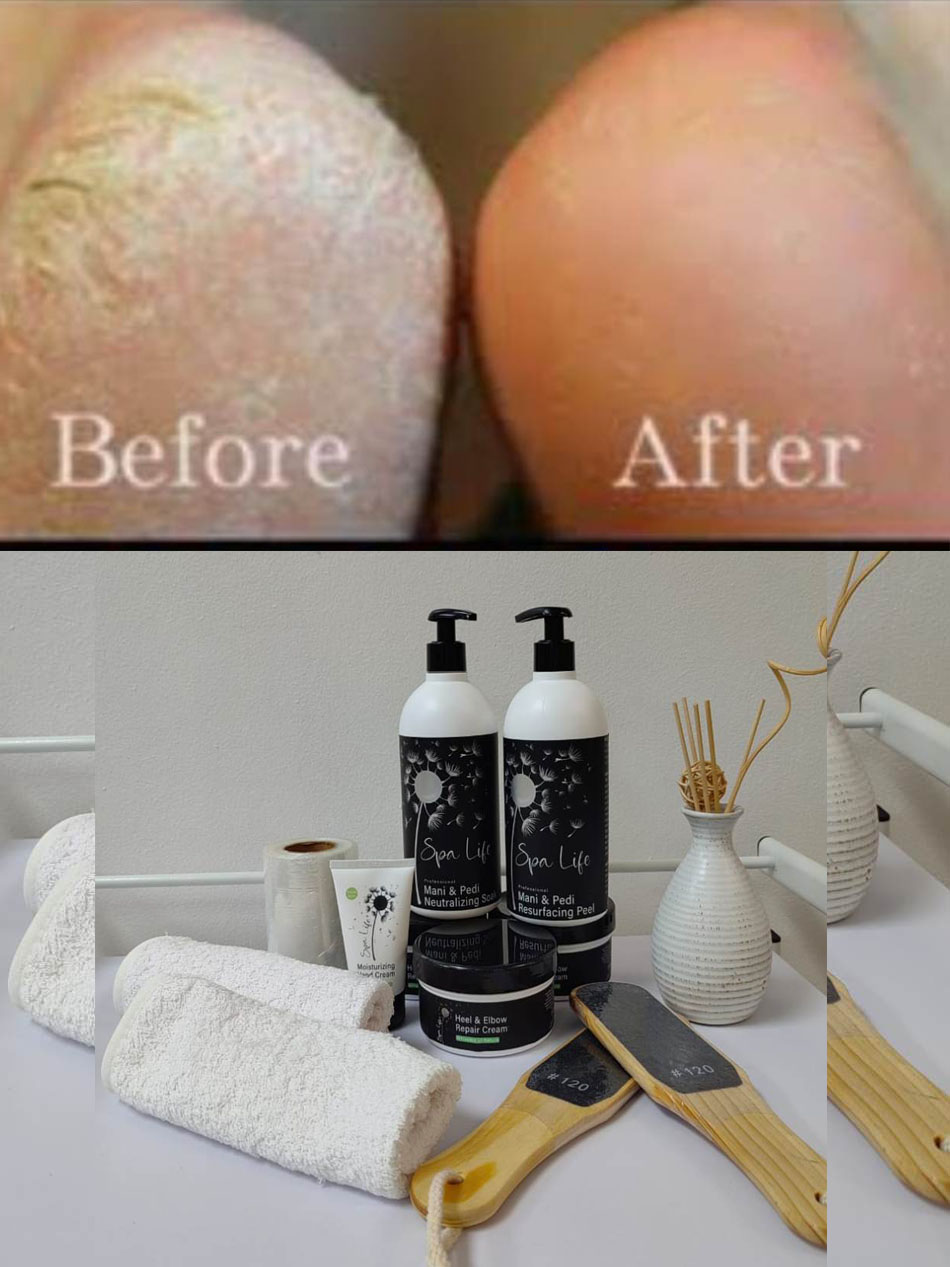Spa Life foot peel0 Spa Life foot peel0